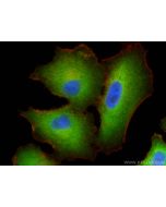 BAG3 Polyclonal antibody, PBS Only 10599-1-PBS proteintech