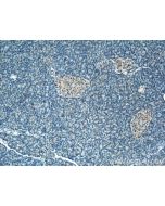 FBXW4 Polyclonal antibody 10657-1-AP proteintech