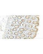 MMS2 Polyclonal antibody 10689-1-AP proteintech