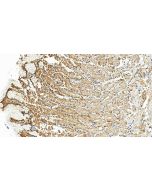 FBXO7 Polyclonal antibody 10696-1-AP proteintech