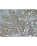 UBE2B Polyclonal antibody 10733-1-AP proteintech