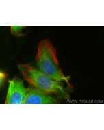 KPNA2 Polyclonal antibody 10819-1-AP proteintech