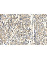 ARPC4 Polyclonal antibody 10930-1-AP proteintech