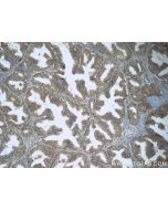 Lactotransferrin/LTF Polyclonal antibody 10933-1-AP proteintech