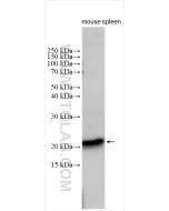 FGF-7/KGF Polyclonal antibody 10939-1-AP proteintech