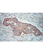 PDHX Polyclonal antibody 10951-1-AP proteintech