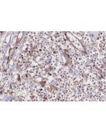 MRPS22 Polyclonal antibody 10984-1-AP proteintech