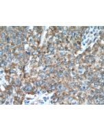 NCLN Polyclonal antibody 10985-1-AP proteintech