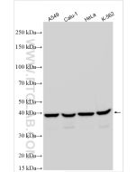 TDP-43 (C-terminal) Polyclonal antibody Proteintech  12892-1-AP