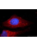 PLOD3 Polyclonal antibody 11027-1-AP proteintech