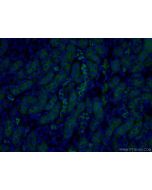 PARD3 Polyclonal antibody 11085-1-AP proteintech