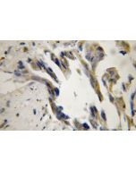 TID1 Polyclonal antibody 11088-1-AP proteintech