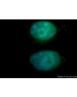 NFE2 Polyclonal antibody 11089-1-AP proteintech