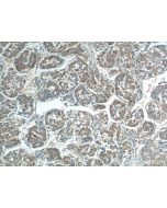 Rab23 Polyclonal antibody 11101-1-AP proteintech
