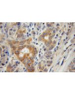 CTDSP2 Polyclonal antibody 11116-1-AP proteintech