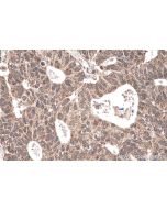 PRPF8 Polyclonal antibody 11171-1-AP proteintech