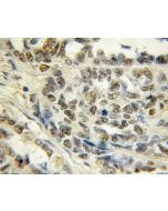 TCEAL7 Polyclonal antibody 11218-1-AP proteintech