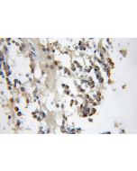 CBFA2T2 Polyclonal antibody 11336-1-AP proteintech
