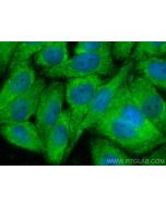 MYDGF/C19orf10 Polyclonal antibody 11353-1-AP proteintech