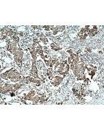 NCKIPSD Polyclonal antibody 11367-1-AP proteintech