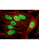 TLE3 Polyclonal antibody 11372-1-AP proteintech