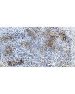LYPD1 Polyclonal antibody 11415-1-AP proteintech