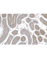 COX6B2 Polyclonal antibody 11437-1-AP proteintech