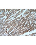COX15 Polyclonal antibody 11441-1-AP proteintech