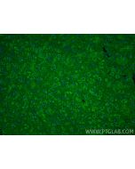 RAB24 Polyclonal antibody 11445-1-AP proteintech