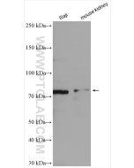 PLAGL2 Polyclonal antibody 11540-1-AP proteintech