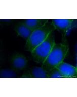 PLSCR1 Polyclonal antibody 11582-1-AP proteintech