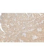 RABL2B Polyclonal antibody 11588-1-AP proteintech