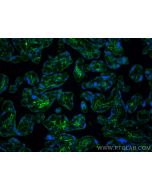 Podoplanin Polyclonal antibody 11629-1-AP proteintech