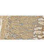 APH1A Polyclonal antibody, PBS Only 11643-1-PBS proteintech