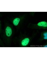 MCM5 Polyclonal antibody 11703-1-AP proteintech
