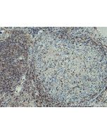 IFITM1 Polyclonal antibody 11727-3-AP proteintech
