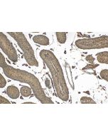 LY96/MD2 Polyclonal antibody 11784-1-AP proteintech