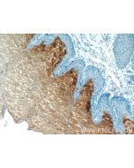 CRNN Polyclonal antibody 11799-1-AP proteintech