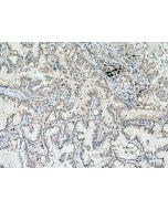 DLEU1 Polyclonal antibody 11860-1-AP proteintech