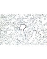 SH2D1A Polyclonal antibody 11868-1-AP proteintech