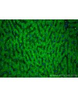 VPS37A Polyclonal antibody 11870-1-AP proteintech