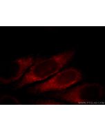 SLC4A4 Polyclonal antibody 11885-1-AP proteintech