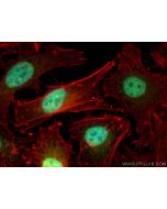 CBP20 Polyclonal antibody 11950-1-AP proteintech