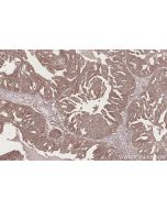 DTX3L Polyclonal antibody 11963-1-AP proteintech