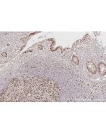 TIPIN Polyclonal antibody 11972-2-AP proteintech