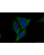 MYCBP Polyclonal antibody 12022-1-AP proteintech