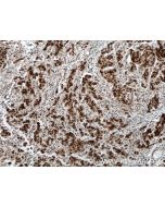 RTF1 Polyclonal antibody 12170-1-AP proteintech