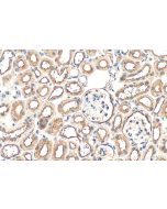ITM2B Polyclonal antibody 12193-1-AP proteintech