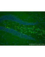 TOMM34 Polyclonal antibody 12196-1-AP proteintech