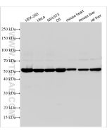 Alpha Tubulin Polyclonal antibody Proteintech  11224-1-AP